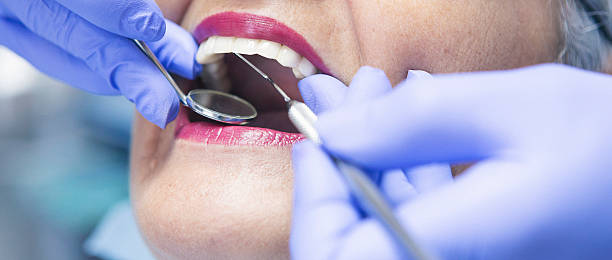 Best Emergency Broken Tooth Repair in Pine Prairie, LA